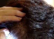 头皮上很多黑头粉刺怎么办 即学头皮清洁2大方法清洁头皮