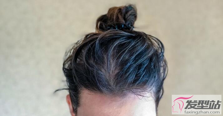 头皮干痒还有头皮屑怎么回事这可能是脂漏性皮肤炎 美发护发 发型站 最新流行发型设计发型图片与美发造型门户网