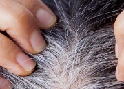 预防白头发食物吃什么？白头发生长位置反映健康和白发原因！